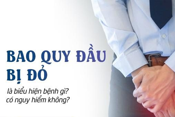 Bao quy đầu bị đỏ biểu hiện của bệnh gì? Nguy hiểm ra sao?