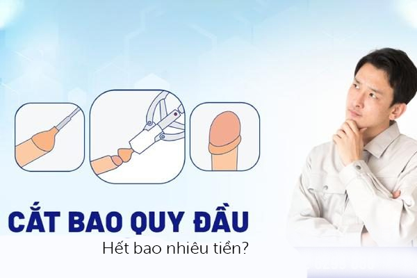 Chi phí cắt bao quy đầu hết bao nhiêu tiền?