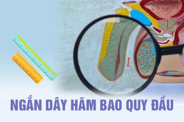 Ngắn dây hãm bao quy đầu (dương vật) ở nam giới