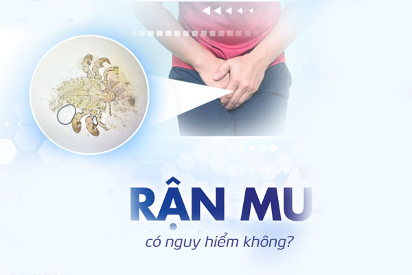 Bệnh rận mu có nguy hiểm không?