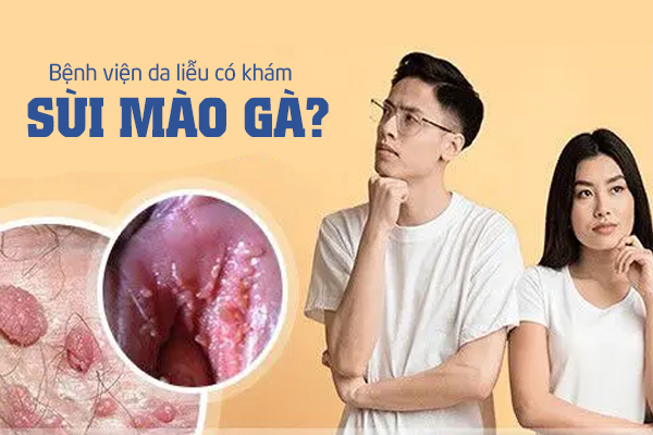Bệnh viện da liễu có khám sùi mào gà không?