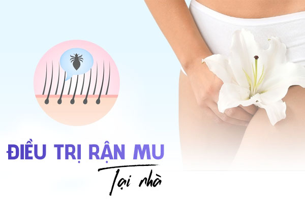 Các cách chữa rận mu tại nhà