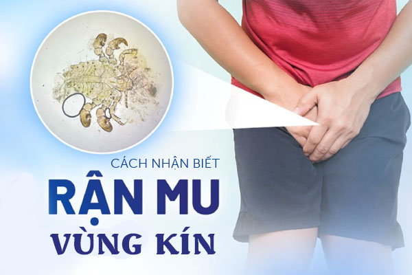 Cách nhận biết bệnh rận mu vùng kín