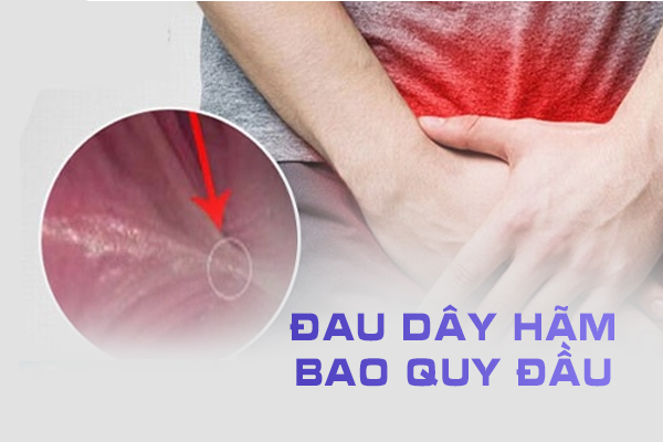 Đau dây hãm bao quy đầu (dương vật)