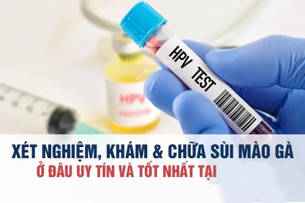 Địa chỉ xét nghiệm sùi mào gà ở đâu uy tín?