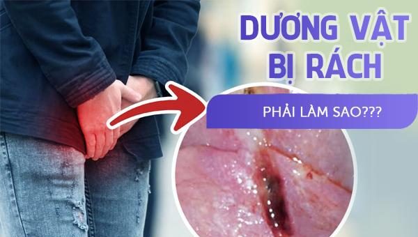 Dương vật bị rách phải làm sao?