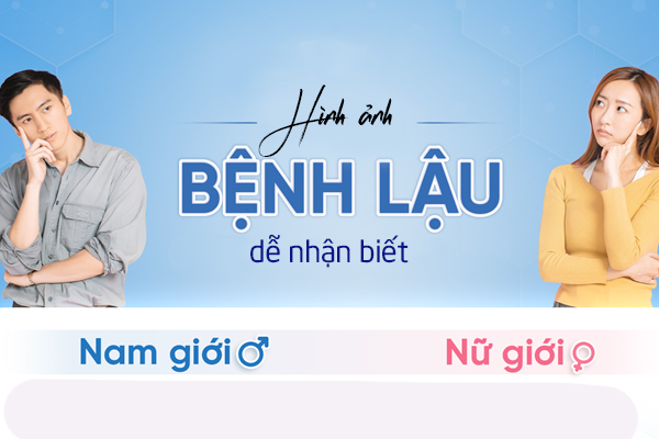 Hình ảnh bệnh lậu dễ nhận biết