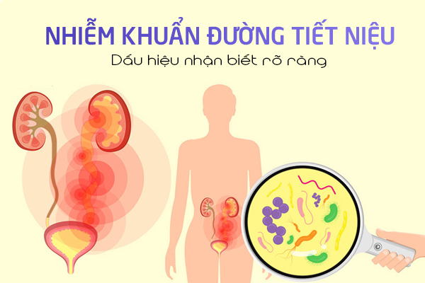 Nhiễm khuẩn đường tiết niệu dấu hiệu nhận biết dễ dàng