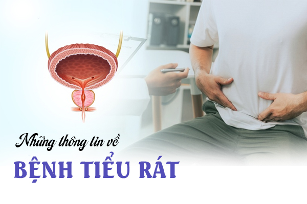 Những thông tin về bệnh tiểu rát