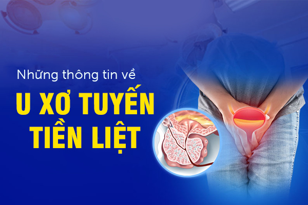 Những thông tin về bệnh u xơ tuyến tiền liệt