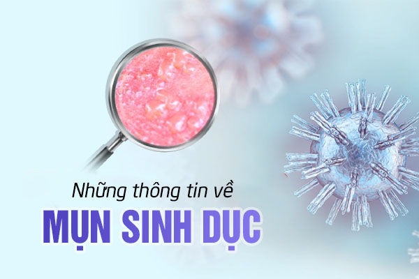 Những thông tin về mụn sinh dục