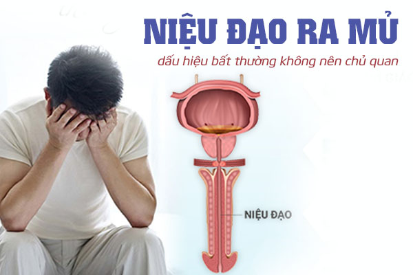 Dấu hiệu bất thường khi niệu đạo chảy ra mủ