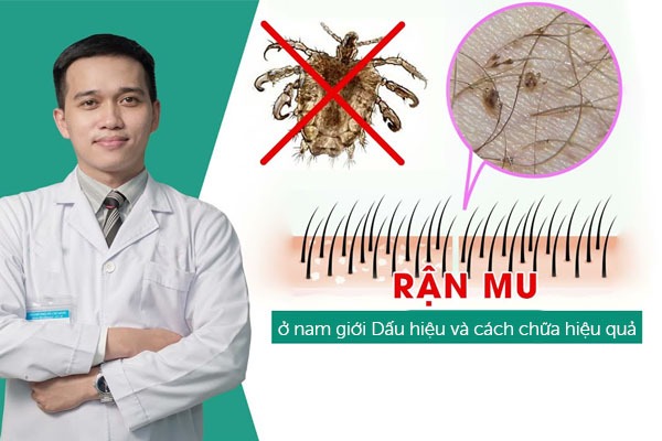Rận mu ở nam giới: Dấu hiệu và cách chữa hiệu quả