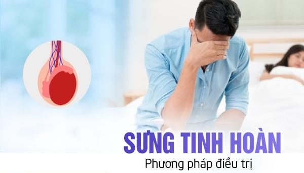 Sưng tinh hoàn và phương pháp điều trị