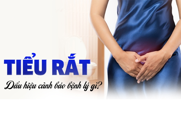 Tiểu rắt là dấu hiệu của bệnh lý gì?