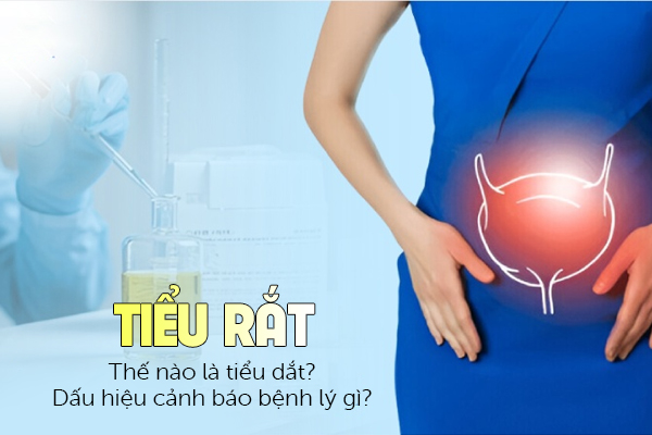 Thế nào là tiểu dắt? Dấu hiệu cảnh báo bệnh lý gì?
