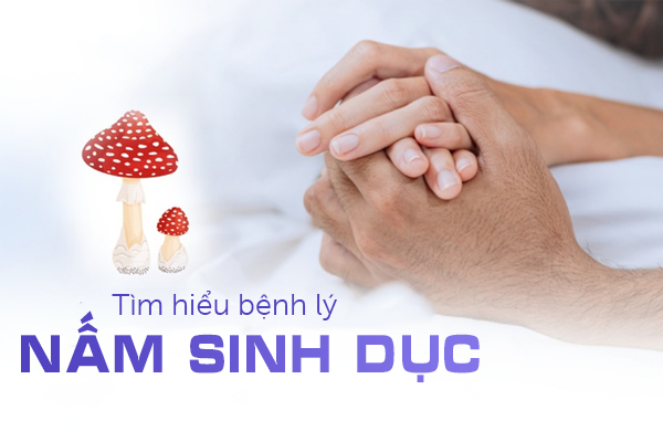 Tìm hiểu về bệnh lý nấm sinh dục
