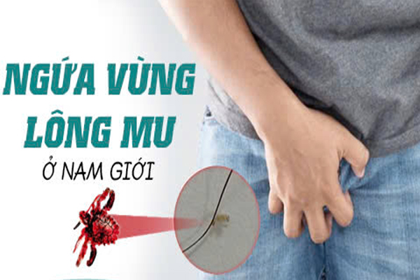 Tình trạng ngứa vùng lông mu ở nam giới