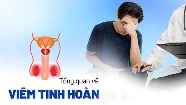 Tổng quan về bệnh viêm tinh hoàn ở nam giới