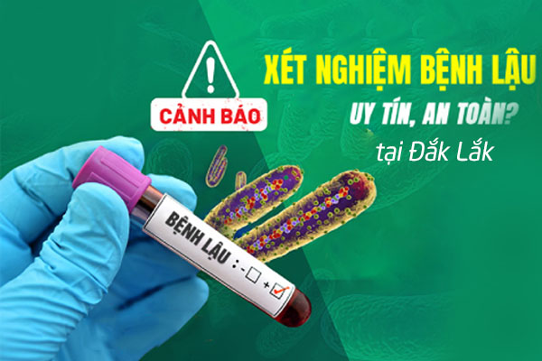 Xét nghiệm bệnh lậu an toàn hiệu quả tại Đắk Lắk