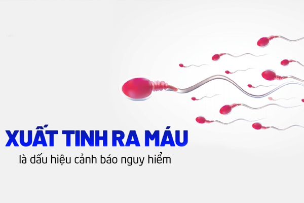 Xuất tinh ra máu là dấu hiệu cảnh báo nguy hiểm