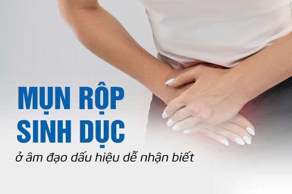 Dấu hiệu nhận biết mụn rộp sinh dục ở âm đạo
