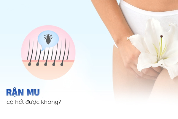 Bệnh rận mu hết được không?