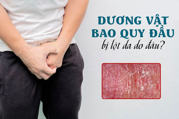 Dương vật/bao quy đầu bị lột da do đâu?