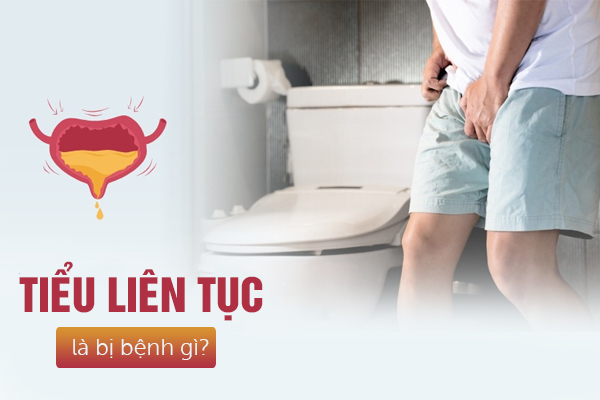 Giải đáp đi tiểu liên tục là bị bệnh gì?