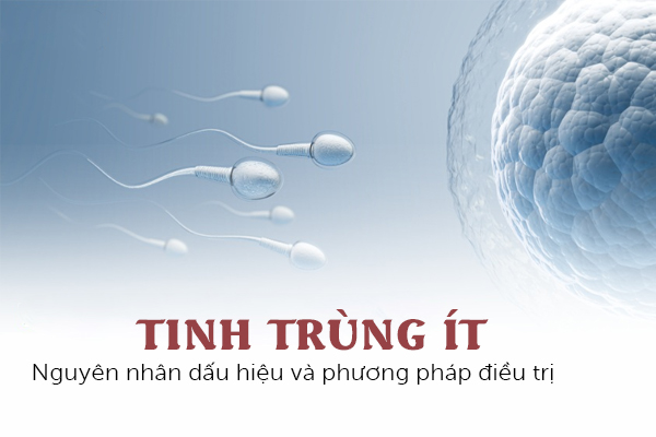 Tinh trùng ít: Nguyên nhân, dấu hiệu và phương pháp điều trị