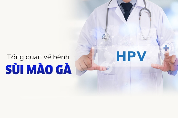 Tổng quan về bệnh sùi mào gà