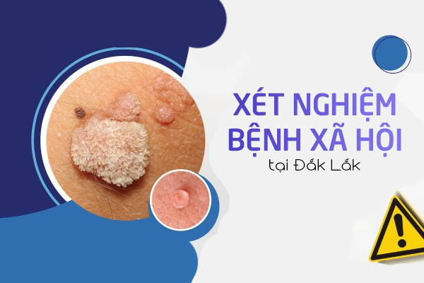 Xét nghiệm bệnh xã hội tại Đắk Lắk