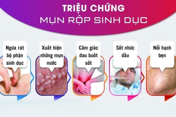 Các triệu chứng của bệnh mụn rộp sinh dục