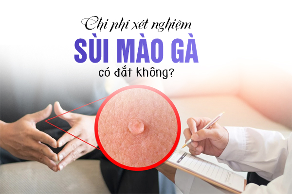 Chi phí xét nghiệm sùi mào gà có đắt không?