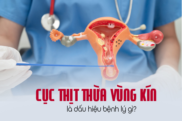 Cục thịt thừa vùng kín là dấu hiệu bệnh lý gì?