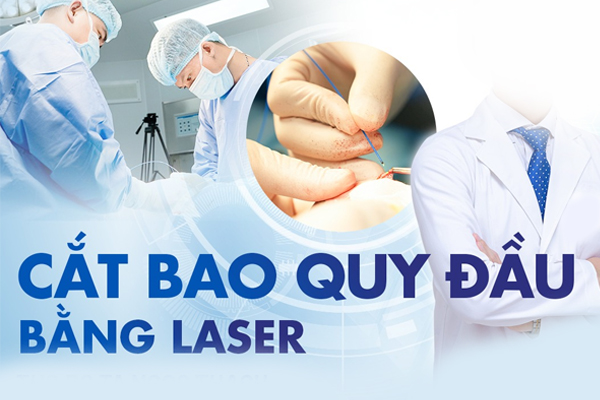 Tìm hiểu về phương pháp cắt bao quy đầu bằng laser