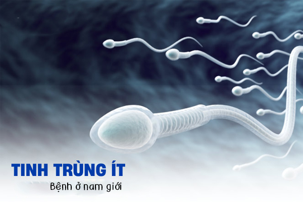 Bệnh tinh trùng ít ở nam giới
