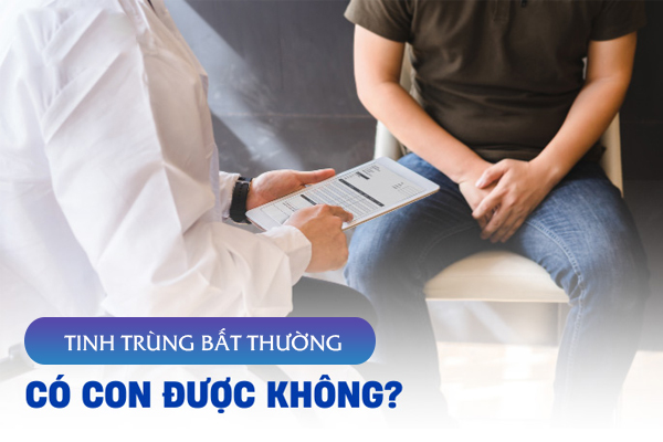 Tinh trùng bị bất thường – nam giới có con được không?