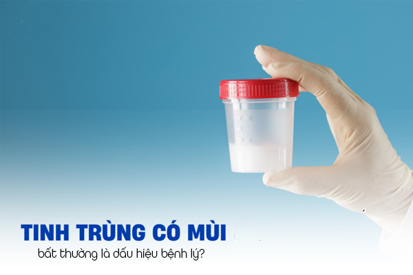 Tinh trùng có mùi bất thường là dấu hiệu một vài bệnh lý