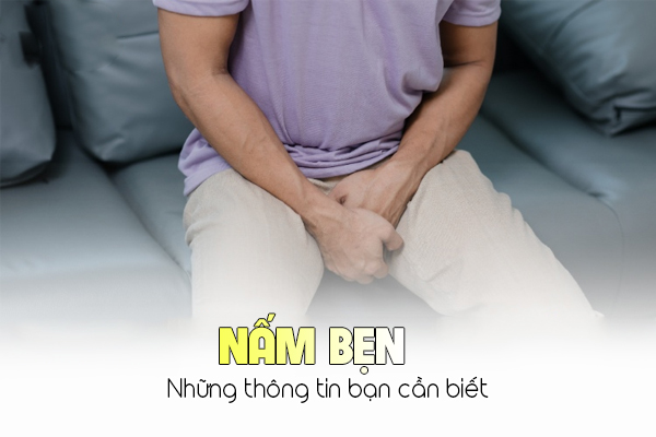 Những thông tin về nấm bẹn bạn cần biết